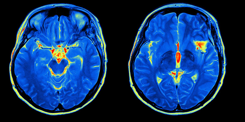 neuroimaging2